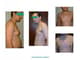 Slider image (9) ProEsthetik